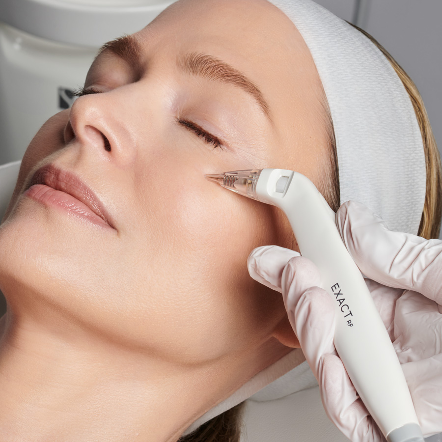 Rejuvenation RF Microneedling