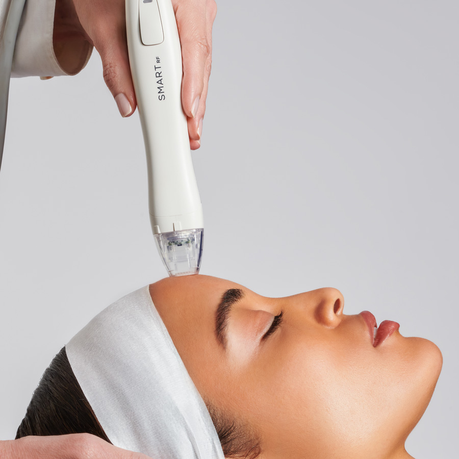 Rejuvenation RF Microneedling